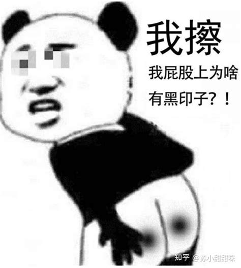 嬰兒屁股黑黑的